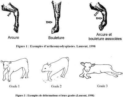 Chirurgie de l'arcure-bouleture