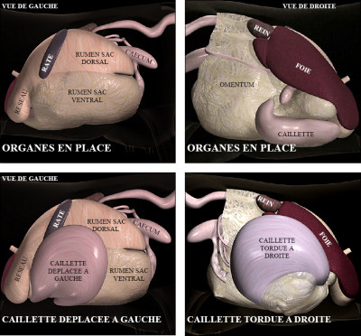 Chirurgie de caillette