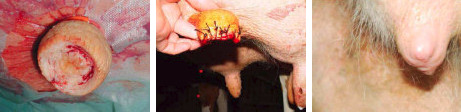 Chirurgie du trayon