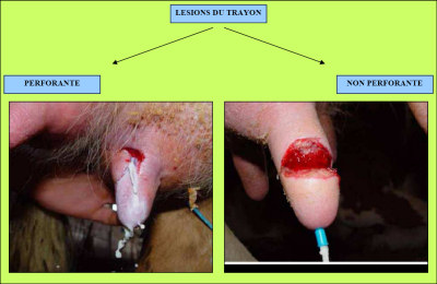 Chirurgie du trayon