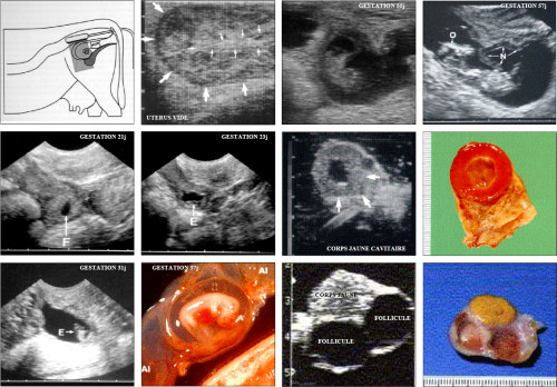 Diagnostic de gestation