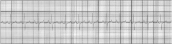 Electrocardiogramme du chien