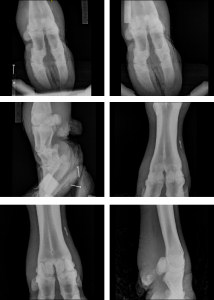 Radiographie numérique